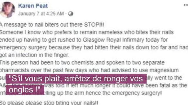 Après avoir vu ces photos, vous ne vous rongerez plus les ongles !