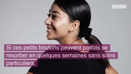"Comment faire disparaître un grain de milium, ce petit bouton disgracieux près des yeux "