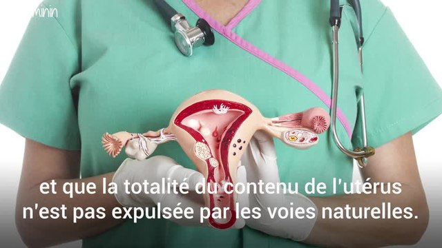 5 choses importantes à savoir sur le curetage