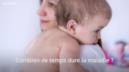 Varicelle : La guerre des boutons