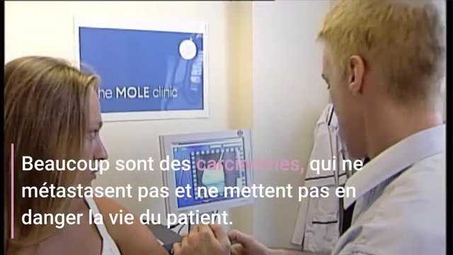 Cancer de la peau : faut-il avoir peur des grains de beauté