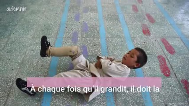 La vidéo de cet enfant qui danse avec sa nouvelle prothèse de jambe a fait le tour du monde