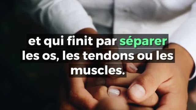 Vous avez cette bosse sur le poignet Ceci devrait vous inquiétez...