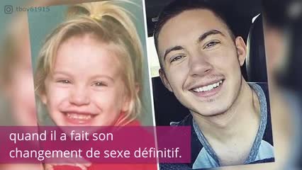 FR_170830-05-transgender-man