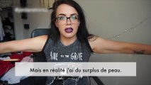 Cette jeune femme parle de ses excès de peau après un régime