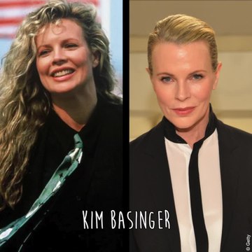 Ces stars qui ont abusé de la chirurgie