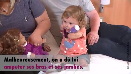Elle reçoit une poupée à son image pour accepter son handicap