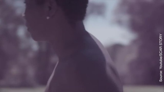 « Nos cicatrices racontent notre histoire ! »