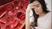 खून की कमी के लक्षण और दूर करने का उपाय | Anemia  symptoms | Boldsky