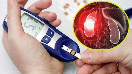 Diabetes के कारण Kidney हो सकती है बुरी तरह खराब ।  इन लक्षणों को भूलकर भी न करें नजरअंदाज