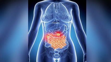 Human Intestine में हो सकते हैं इतने Virus, जरूर देखें ये वीडियो | Boldsky