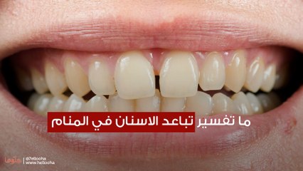 ما تفسير تباعد الاسنان في المنام