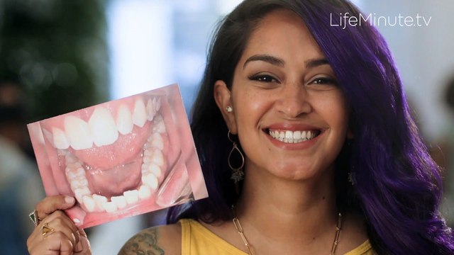 Teeth Straightening Benefits More Than Just Your Smile