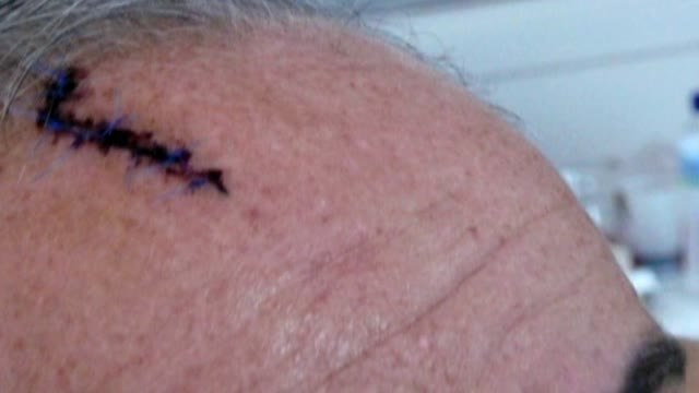 José Luis Moreno: una paliza, dos robos y dos juicios