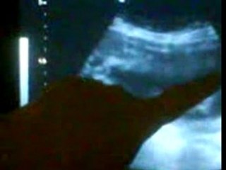 Liam echographie 24eme semaine et demi le 28.02.2008