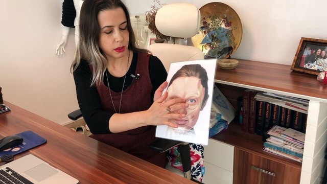 Botoks nasıl yapılır?