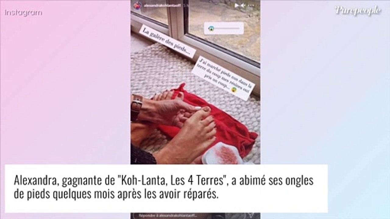 Alexandra (Koh-Lanta) : Ses "pieds dégueulasses" soignés... et de nouveau abîmés !