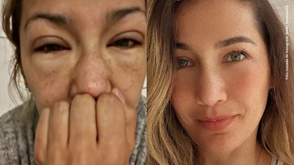 Adriana Betancur revela la verdad detrás del irreconocible rostro que tenía