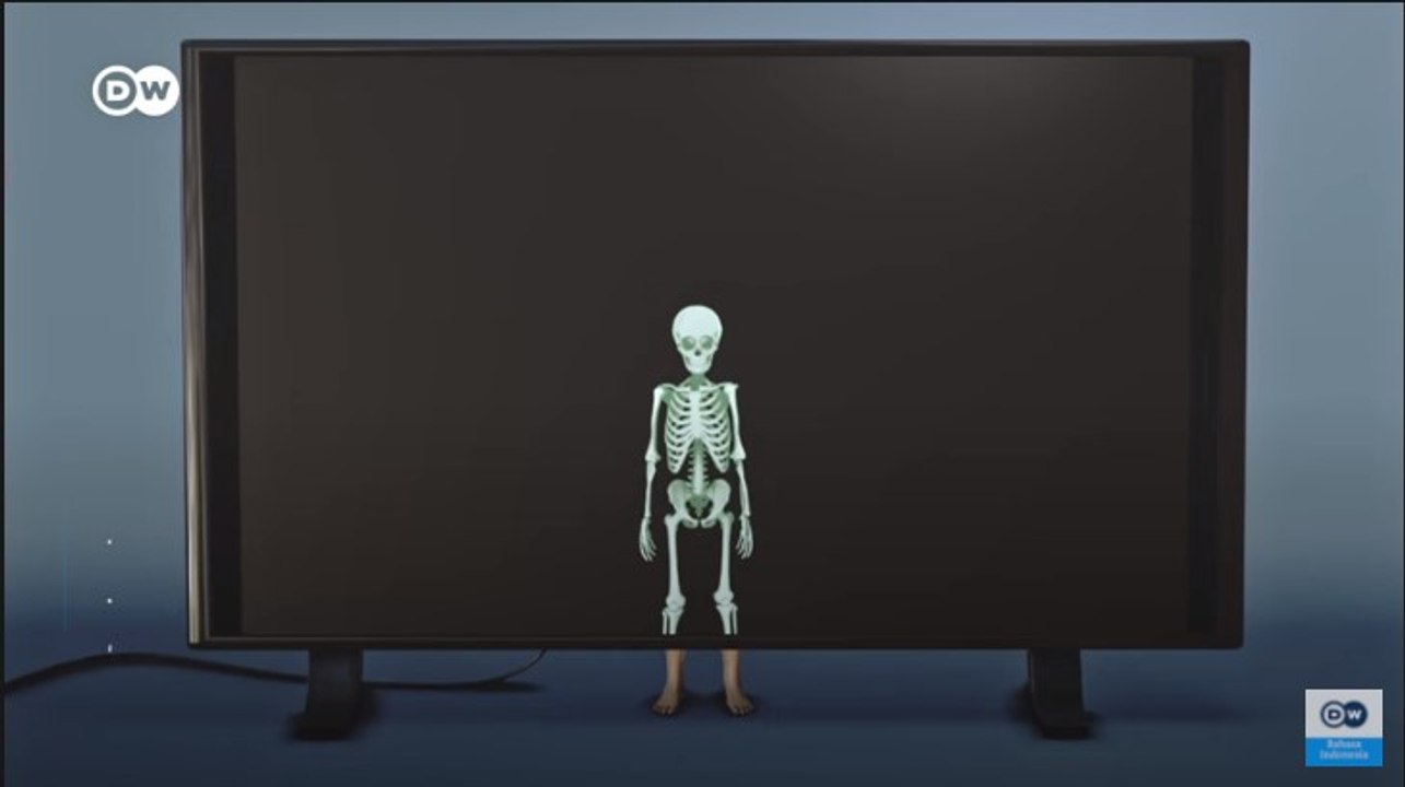 Apa Fakta Unik Tentang Tulang yang Perlu Kamu Ketahui?