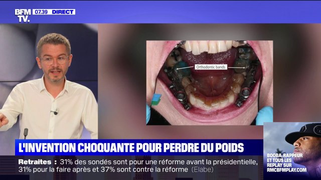 Verrouiller votre bouche pour perdre du poids: l'invention troublante de chercheurs néo-zélandais