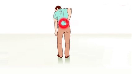 bd-diferencia-entre-ciatica-y-dolor-lumbar-010721