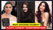 Anushka Sharma, Priyanka Chopra, Esha Gupta | Celebs Who Did Plastic Surgery