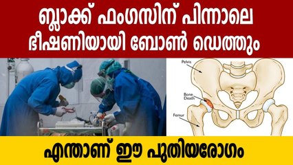 കൊവിഡ് രോഗികളിൽ ഭീഷണിയായി ബോൺ ഡെത്ത്