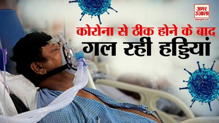 कोरोना के साइड इफेक्ट, गलने लगी हड्डियां | Corona Side Effects After Black Fungus Bone Death