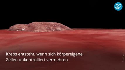 Download Video: Krebs und Corona: Hilft neuer Impfstoff auch bei Krebs