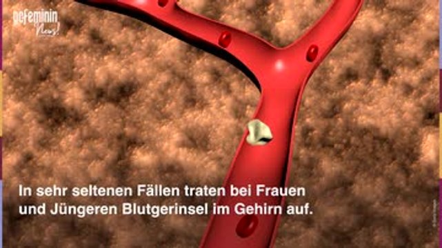 AstraZeneca für alle: Alle wichtigen Infos zur Impfung