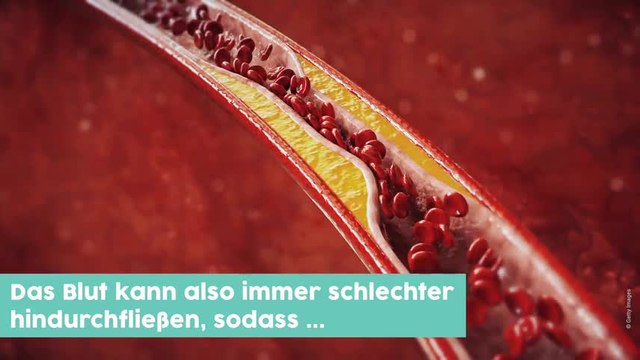 Schon gewusst So verändert Rauchen deinen Körper