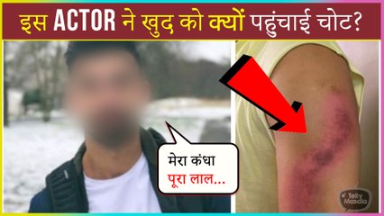 This Actor Hits Himself While Doing An Emotional Scene