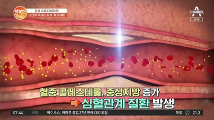 비만도 서러운데ㅠ! 비만이 혈관질환의 씨앗이라고요?