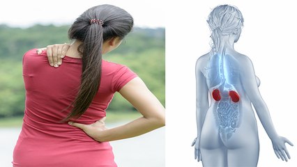 Back Pain आपका Kidney Problem का इशारा तो नहीं, Doctors Advice | Boldsky