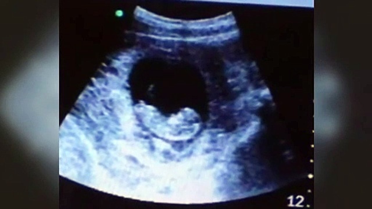 Imágen de demonio mirando a un bebe aparéce en ultrasonido REAL 2016