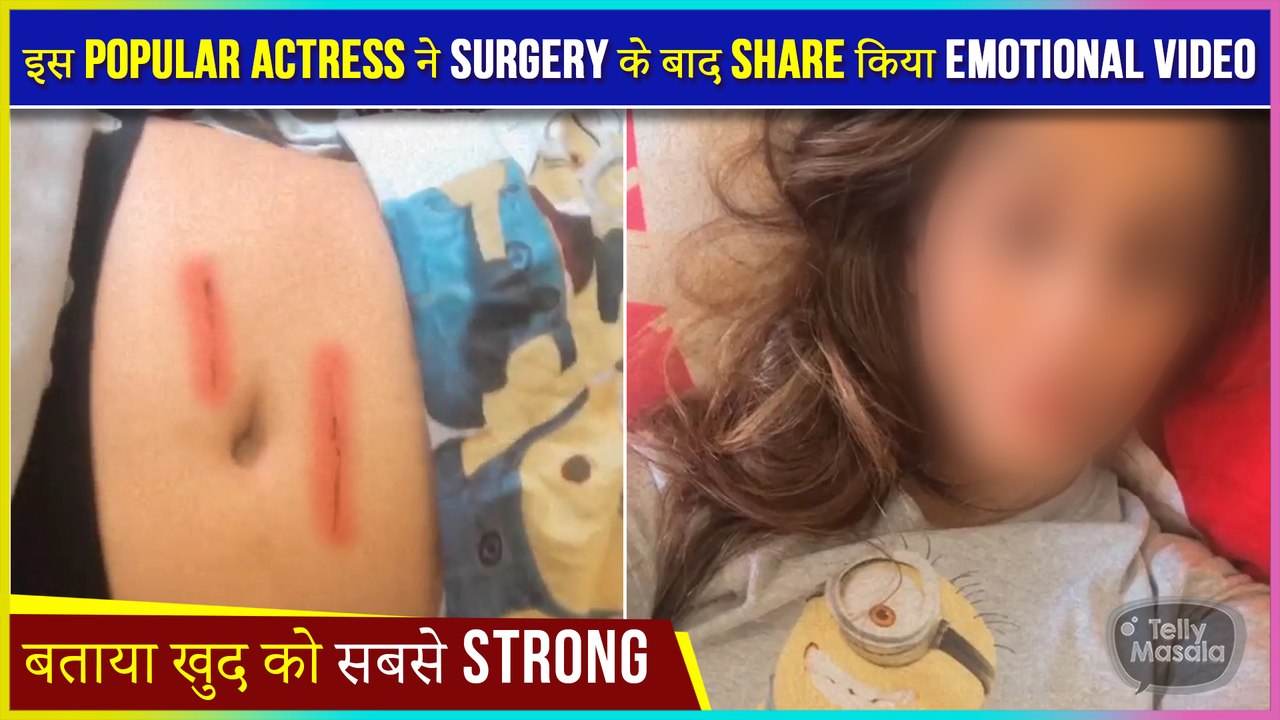 This Popular Actress Shares The Video After Surgery | Shows Her Stitches Proudly