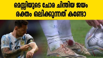Lionel Messi played with bleeding leg as Argentina beat Colombia