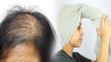 बाल झड़ना बिलकुल होगा बंद आज से ही अपनाएं ये तरीका, चौंकाने वाला असर | Boldsky