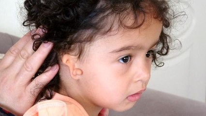 Doğuştan kulağı olmayan minik Zelal'in annesi yardım bekliyor