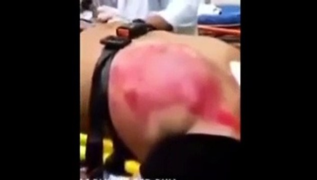 24 tane enerji içeceği içen adamın şok görüntüsü