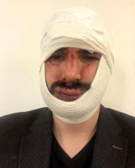 Anadolu Ajansı muhabirini darp eden saldırganlar tutuklandı