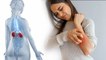 Body में ज्यादा Itching Kidney Problem का खतरनाक Symptoms, Doctors Advice | Boldsky