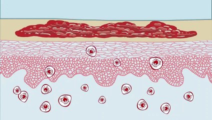Tudo Sobre Psoríase: Causas, Sintomas e Tratamentos 🩺