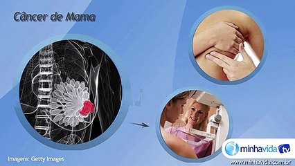 Mamografia: exame detecta câncer de mama