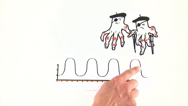 Tire todas as suas dúvidas sobre o tratamento da artrite reumatoide