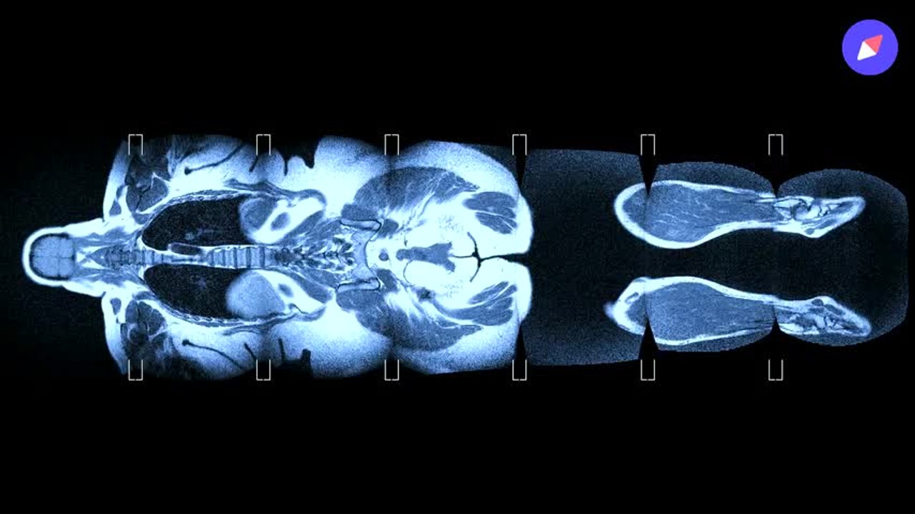 Calculer et comprendre son IMC