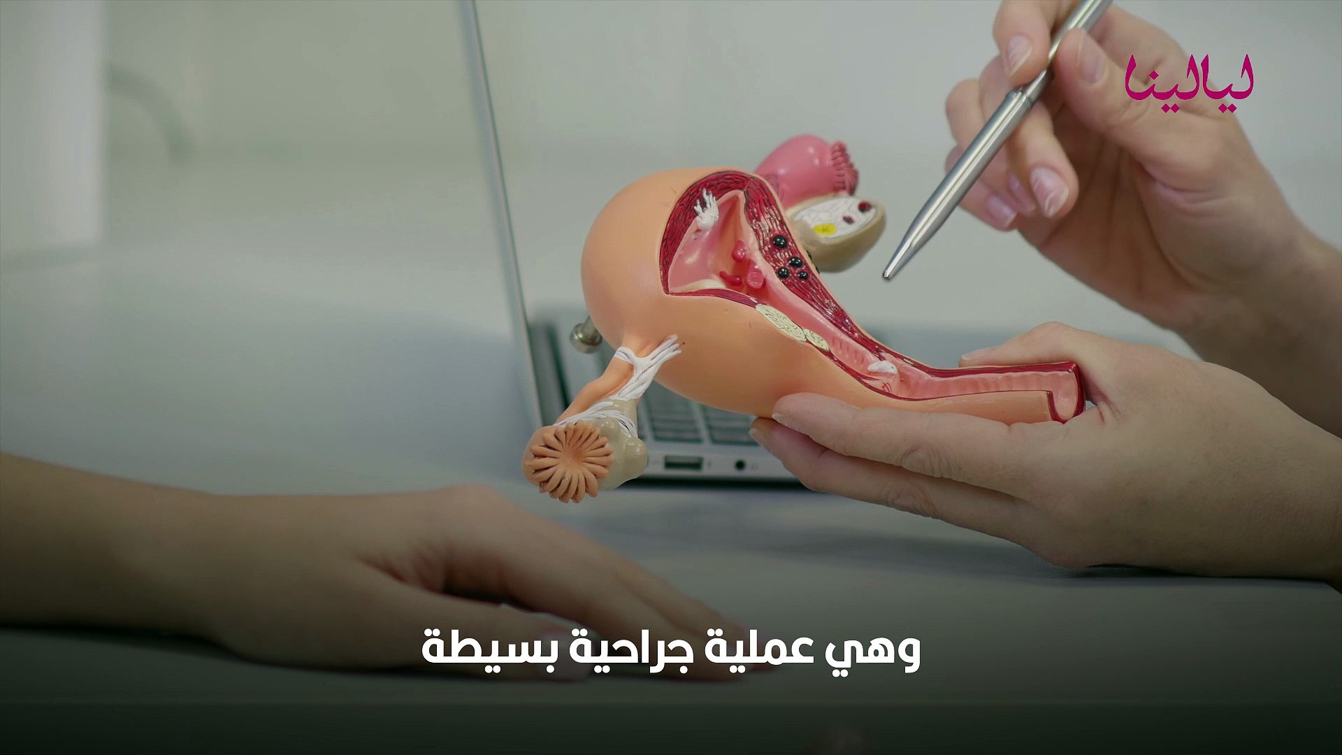 تنظيف الرحم من الأوساخ - فيديو Dailymotion