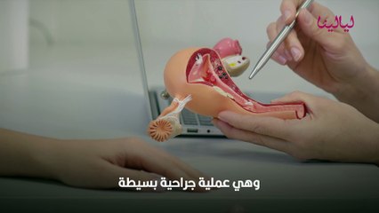 تنظيف الرحم من الأوساخ