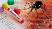 Zika Virus Test कैसे किया जाता है ? | How to do Zika Virus Test | Boldsky