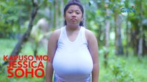 Kapuso Mo, Jessica Soho: 10-ANYOS NA BABAE SA PALAWAN, NASA 12 KILO ANG BIGAT NG DIBDIB!